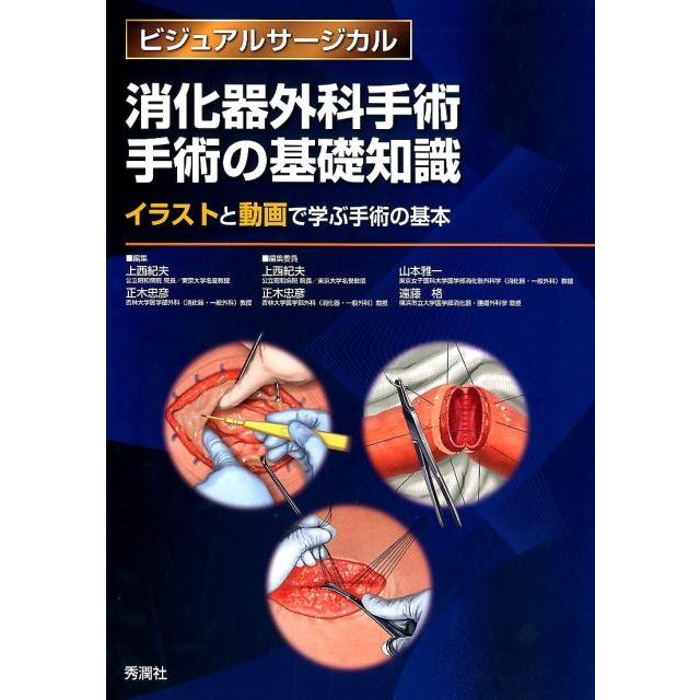 上西紀夫 消化器外科手術手術の基礎知識 イラストと動画で学ぶ手術の
