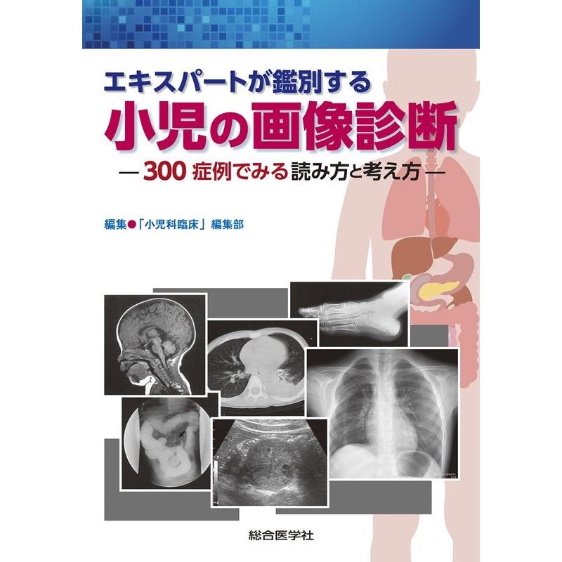 小児科臨床」編集部 エキスパートが鑑別する小児の画像診断 300