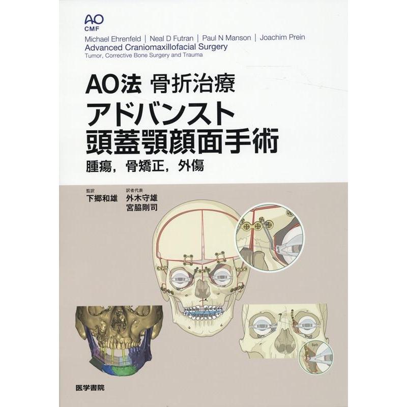 【裁断済み】AO法 骨折治療 アドバンスト 頭蓋顎顔面手術 Michael Ehrenfeld AO法骨折治療アドバンスト頭蓋顎顔面手術 腫瘍,骨