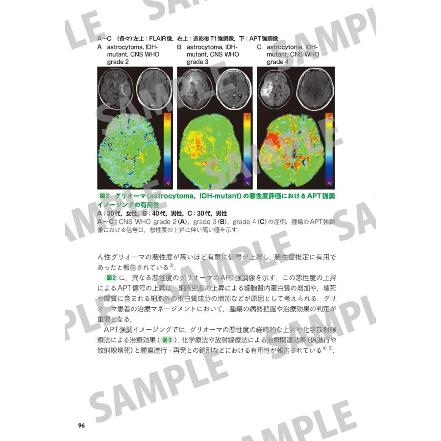 平井俊範 MRI一問一答 撮像法選択と読影に""必ず""役立つ基礎知識 Book |  | 04
