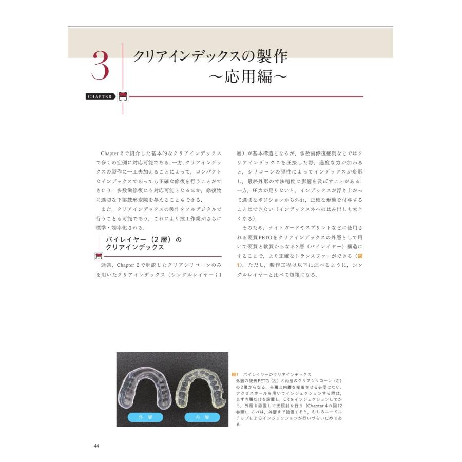 保坂啓一 CR修復が速く確実・きれいに行える クリアインデックス