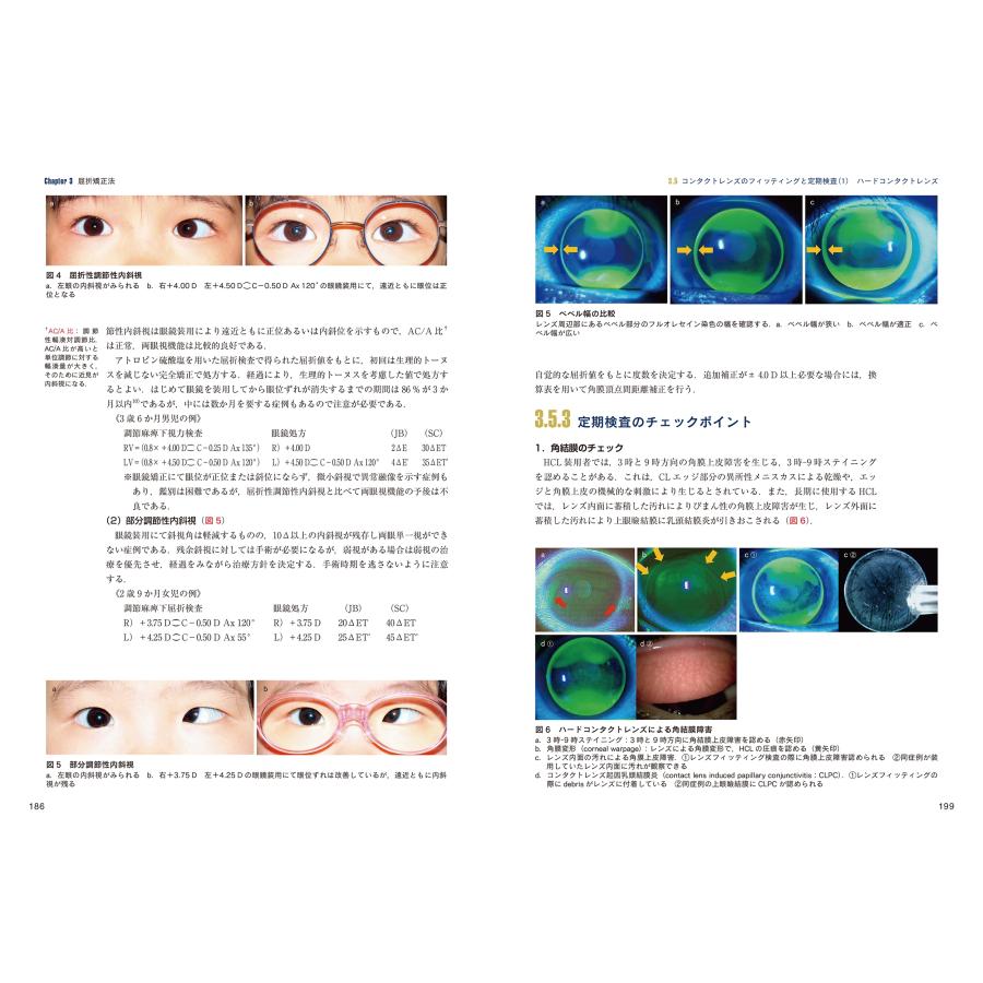 $裁断済 最新 屈折異常と視力矯正マニュアル 堀裕一 最新 屈折異常と視力矯正マニュアル (7巻) 検査の基本から矯正