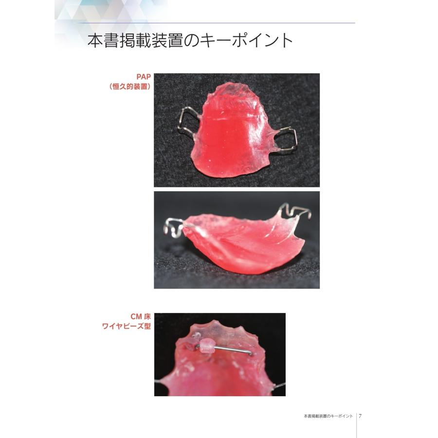 舘村卓 解剖・生理・機能で考える 摂食嚥下障害・構音障害のための口腔内装置 PAP,CM床,PLP,スピーチバルブ,口唇プレー Book |  | 01