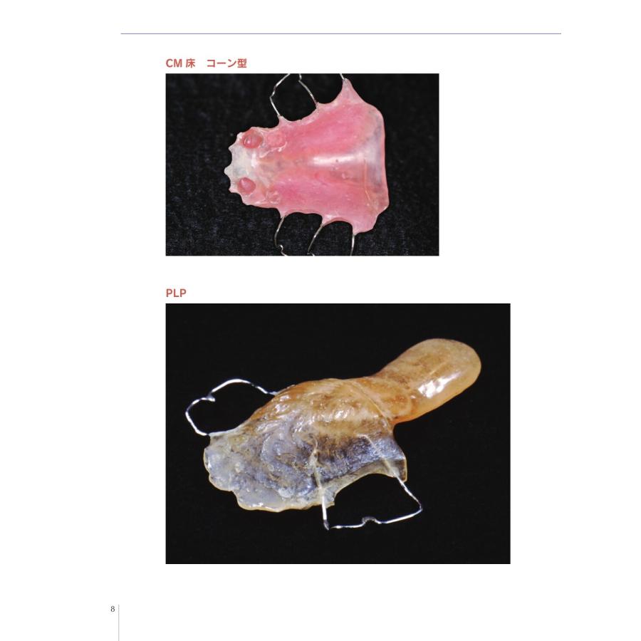 舘村卓 解剖・生理・機能で考える 摂食嚥下障害・構音障害のための口腔内装置 PAP,CM床,PLP,スピーチバルブ,口唇プレー Book |  | 02