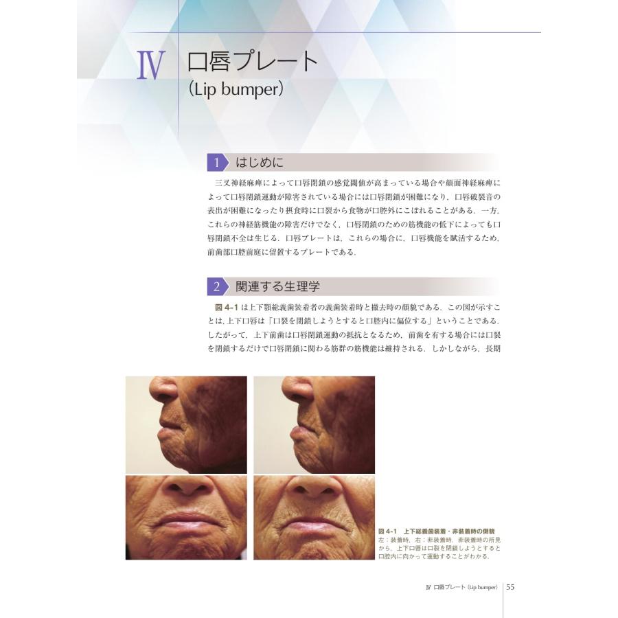 舘村卓 解剖・生理・機能で考える 摂食嚥下障害・構音障害のための口腔内装置 PAP,CM床,PLP,スピーチバルブ,口唇プレー Book |  | 05