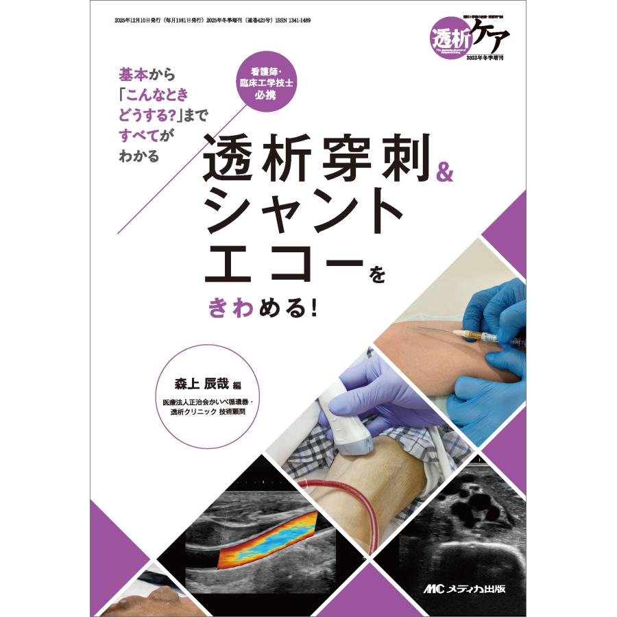 森上辰哉 透析穿刺&シャントエコーをきわめる! 基本から「こんなときどうする?」まですべてがわかる Book | 