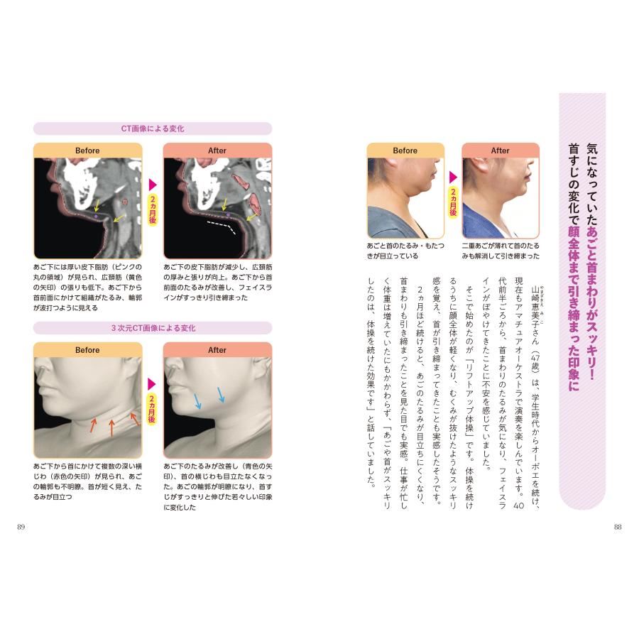 奥田逸子 首のしわ たるみ 口元の小じわ・二重あご 何歳からでもここまで若くなる! 名医が教える最新1分体操大全 Book |  | 08