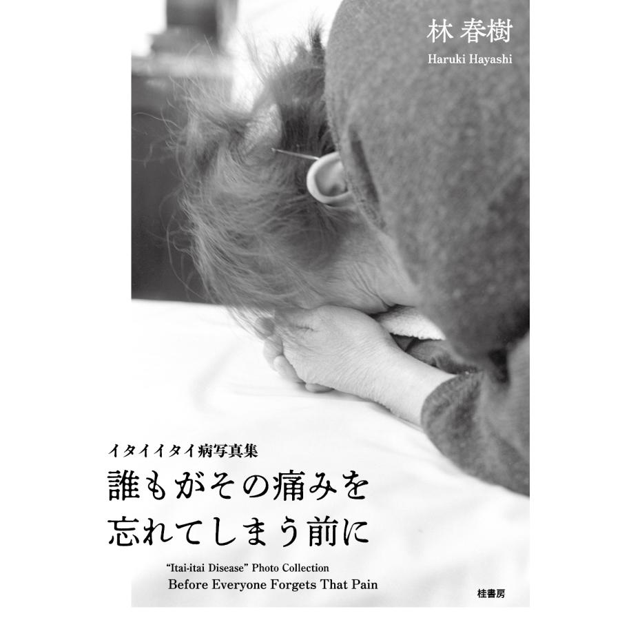 林春樹 誰もがその痛みを忘れてしまう前に イタイイタイ病写真集 Book | 