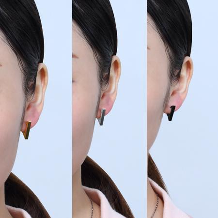 ピアス 18K レディース アレルギー対応 小さめ フープピアス メンズ