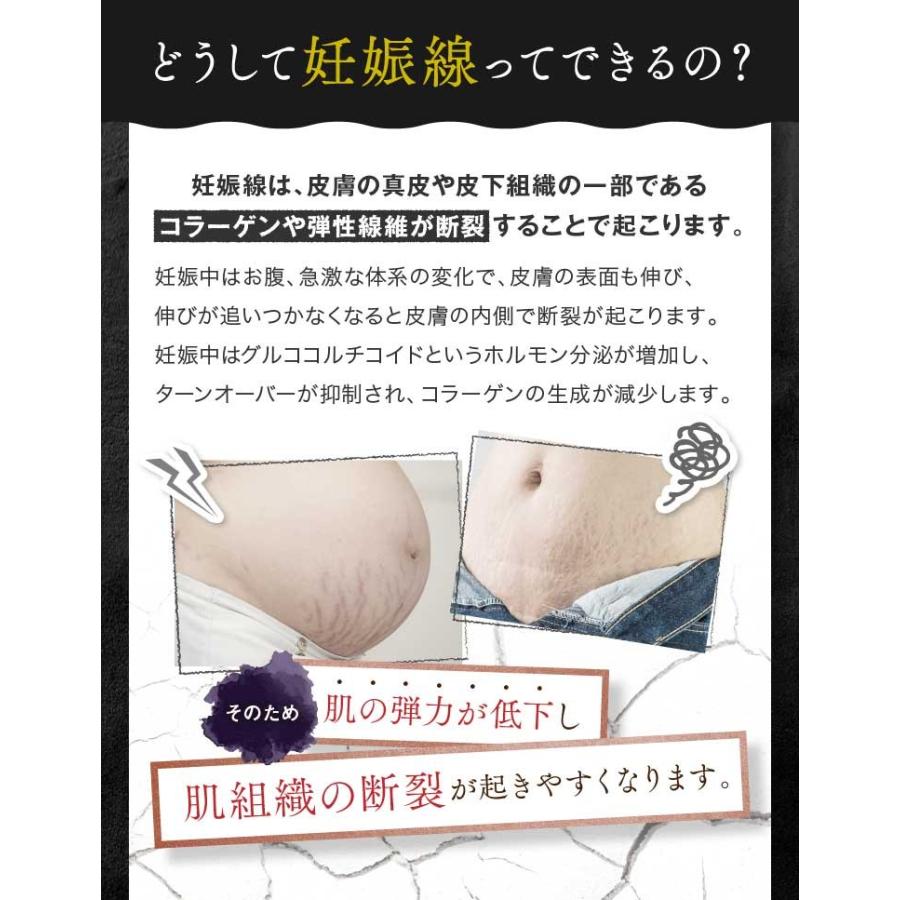 コロコロ妊娠線クリーム ヒヨコスマイル ８０ｇ クインビーハッピーマッサージソルト１００ｇおまけ付 国内生産 妊娠前 産後 妊娠線予防クリーム 20191001001 トライコレクション 通販 Yahoo ショッピング