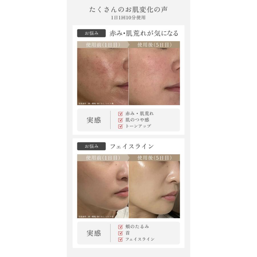 LDM水滴家庭用美顔器 SELINI LDM BOOST PRO 美シェーバー特典付き