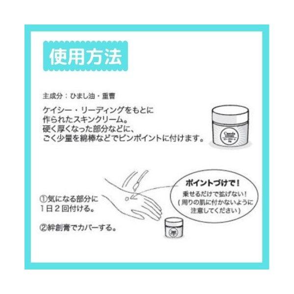 カソーダクリーム casoda 30g ひまし油 重曹 肌ケア ナチュラル オーガニック スキンケア ピンポイントケア 送料無料 翌営業日出荷｜trea-villa｜02