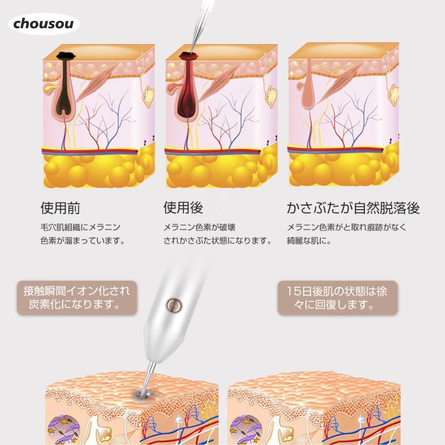 ［新品］特別価格シミケアポレーション　ほくろ、シミ取り　箱潰れ一部あり レーザーペン レーザースポットペン レーザー除去ペン 美顔器