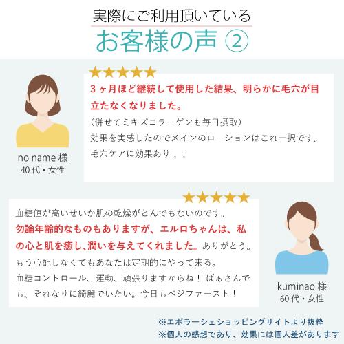 エポラーシェ エルローション 300mL サロン販売 化粧水 アーチチョーク葉エキス 毛穴ケア エイジングケア 1028 |  | 07