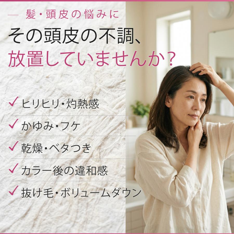 エポラーシェ スカルプガードEX 洗い流し専用 クレンジングスプレー 無添加 カタラーゼ 頭皮 |  | 01