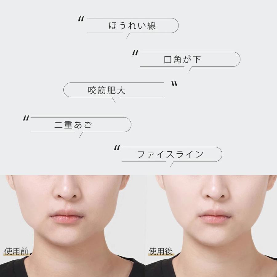 小顔ベルト 美顔器 ems 小顔マッサージ器 小顔 リフトアップ 顔 小顔ベルト 美顔器 ems 小顔マッサージ器 小顔 リフトアップ 顔