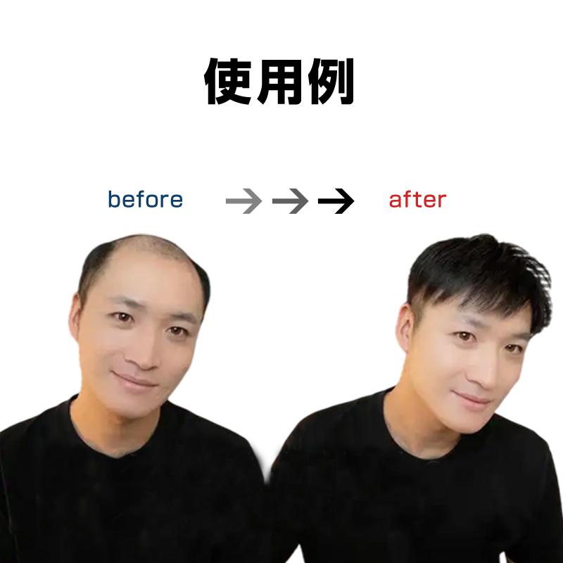 ウィッグ メンズ 男性 ヘアピース 人毛100％ 頭頂部 部分ウィッグ