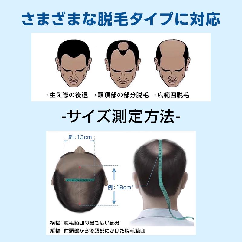 ウィッグ メンズ 男性 ヘアピース 人毛100％ 頭頂部 部分ウィッグ トップカバー 薄毛 白髪隠し 増毛 ボリュームアップ 自然 簡単装着 通気性 かつら 黒 ブラック ウィッグ メンズ 男性 ヘアピース 人毛100％ 頭頂部 部分ウィッグ