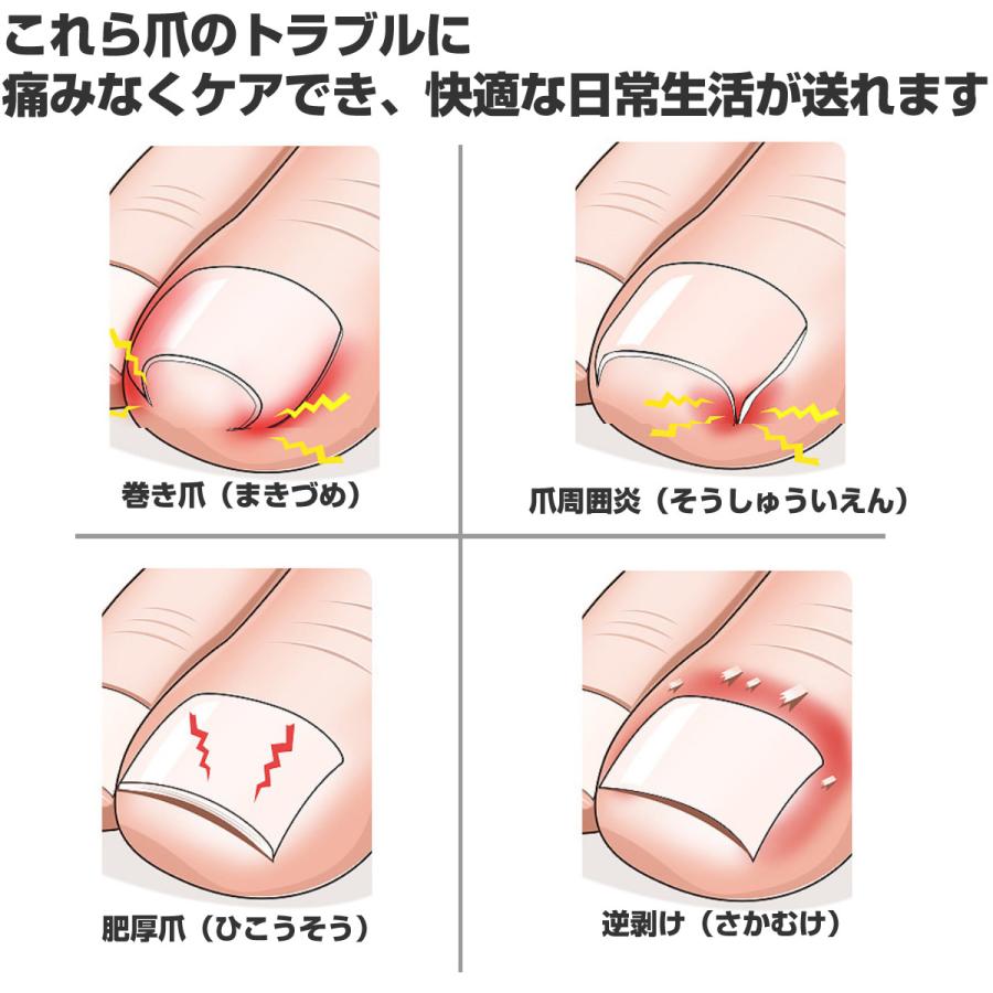 爪切りニッパー 5点セット ネイルクリッパー 巻き爪 深爪 硬い爪