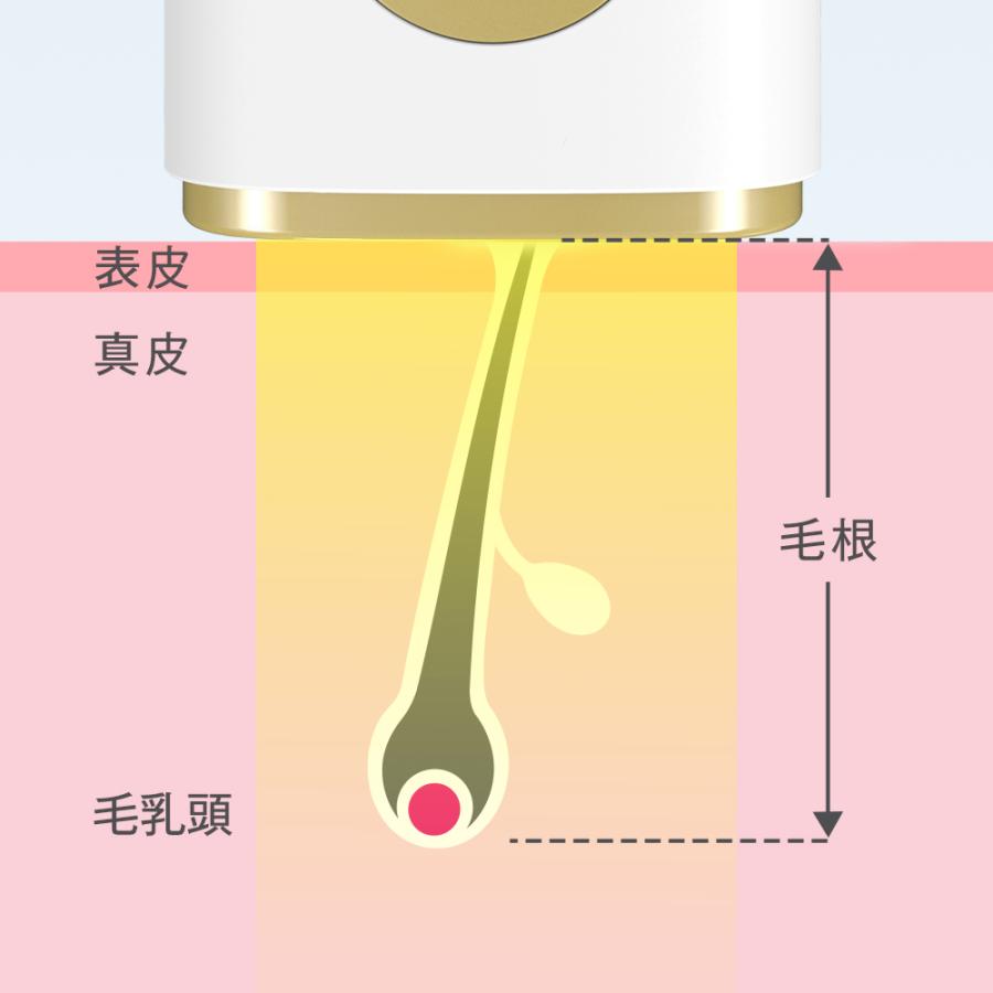 【超お得】家庭用光脱毛器 全身用 値下げしました！！ TAKUYO 「全身適用」 脱毛器 5段階レベル 家庭用脱毛器 HIPL 痛くない