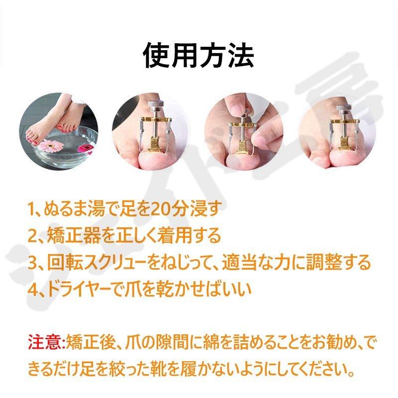 感謝の声続々 巻き爪 巻爪 丸まった爪 をまっすぐに 2個セット 補正 する サポーター ネイルケア 治し方 自分で 巻き爪クリップ 矯正器具 グッズ 矯正 フットケア Aynaelda Com