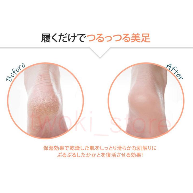 ルームソックス 靴下 かかとサポーター 発熱ソックス 3足セット 冷えとり 発熱靴下 あったか保温 保湿効果 角質ケア 寒さ対策 |  | 03