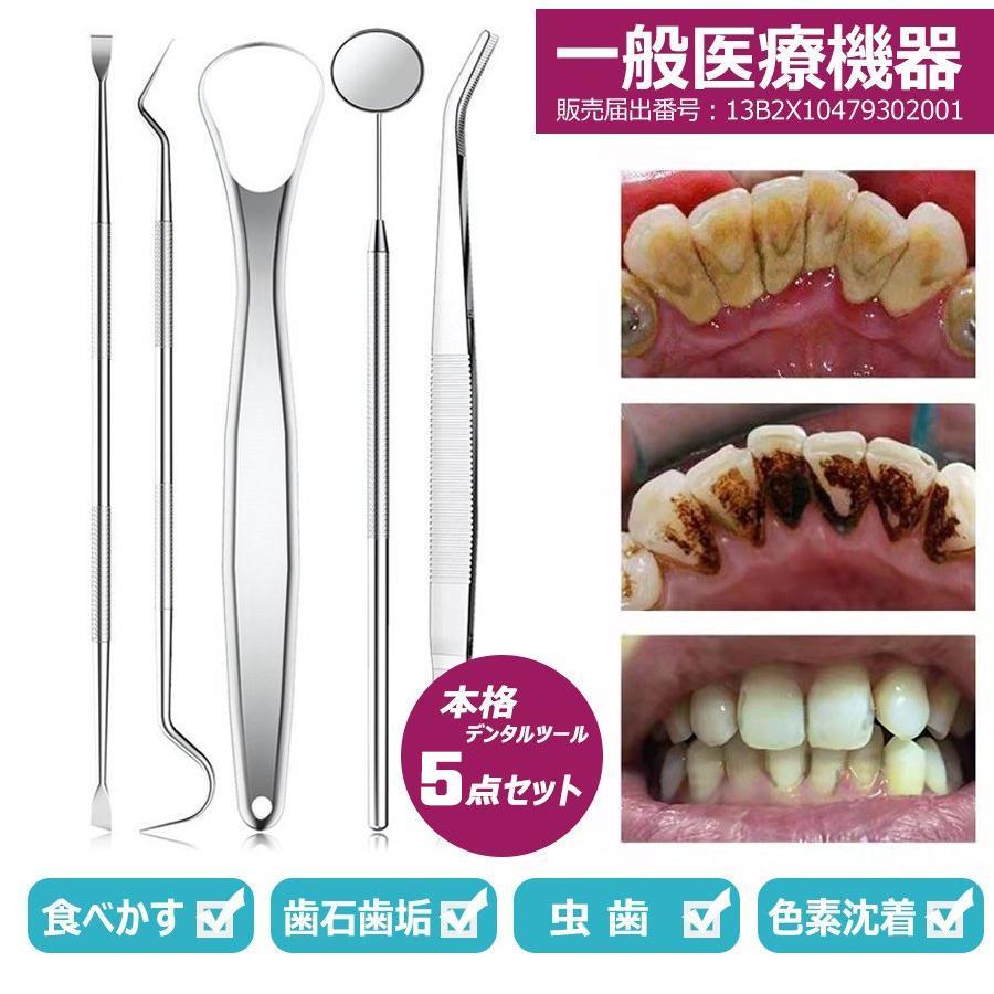 正規医療認証品 歯石取り スケーラー 歯石 スケーラー 歯 歯石除去 5点セット 自宅 デンタルケア 虫歯 予防 歯垢 歯鏡 口腔ケア ケース付 の商品画像