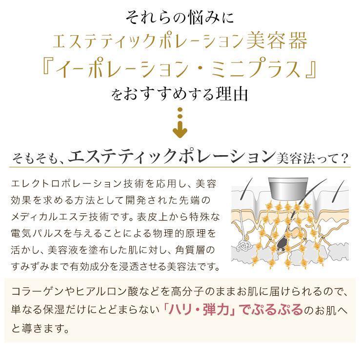 イーポレーション 美顔器 たるみ ほうれい線 目元 口元 イーポレーション 美顔器 たるみ ほうれい線 目元 口元