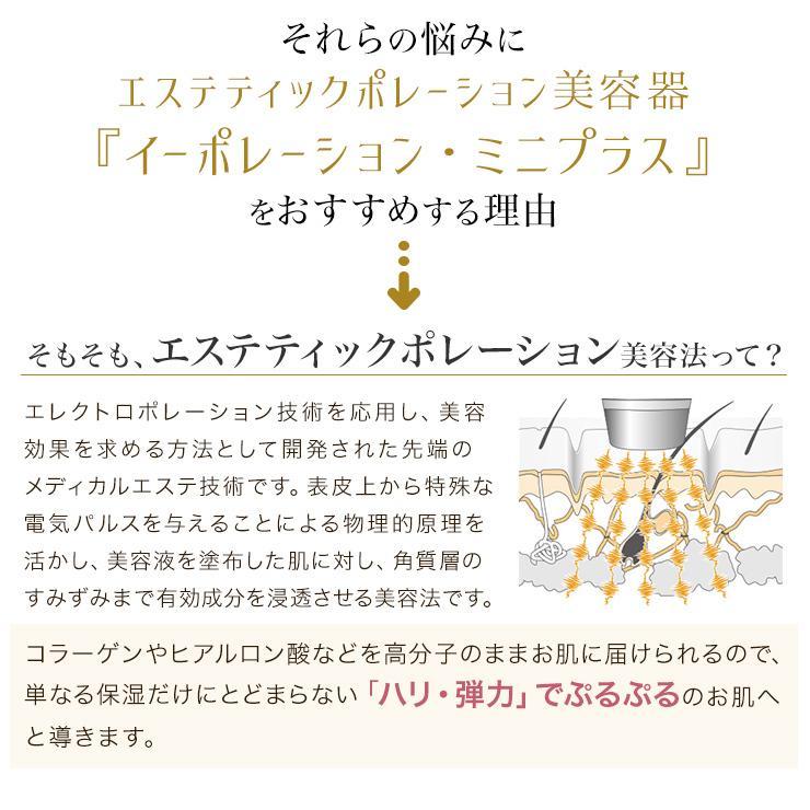 美顔器 たるみ ほうれい線 目元 口元 エイジング リフトアップ / エレクトロポレーション イーポレーション・ミニプラス 特典付き｜ubp｜09