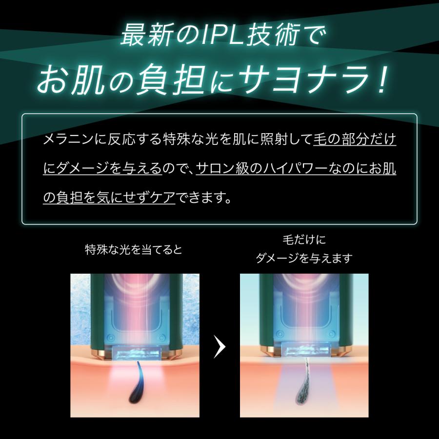 Ulike 【30%offクーポン利用⇒27,300円】脱毛器 光美容器 ULIKE Ulike 【30%offクーポン利用⇒27,300円】脱毛器 光美容器 ULIKE