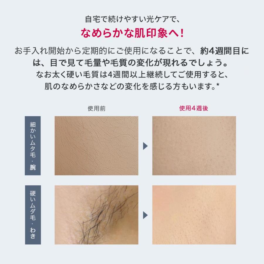＼クーポンで24,940円！2/2〜2/28／Ulike公式 Air2 光美容器 脱毛 vio ムダ毛処理 フラッシュ脱毛 美顔器 メンズ レディース 痛みレス 男女兼用 ヒゲ脱毛 髭脱毛 | Ulike | 12