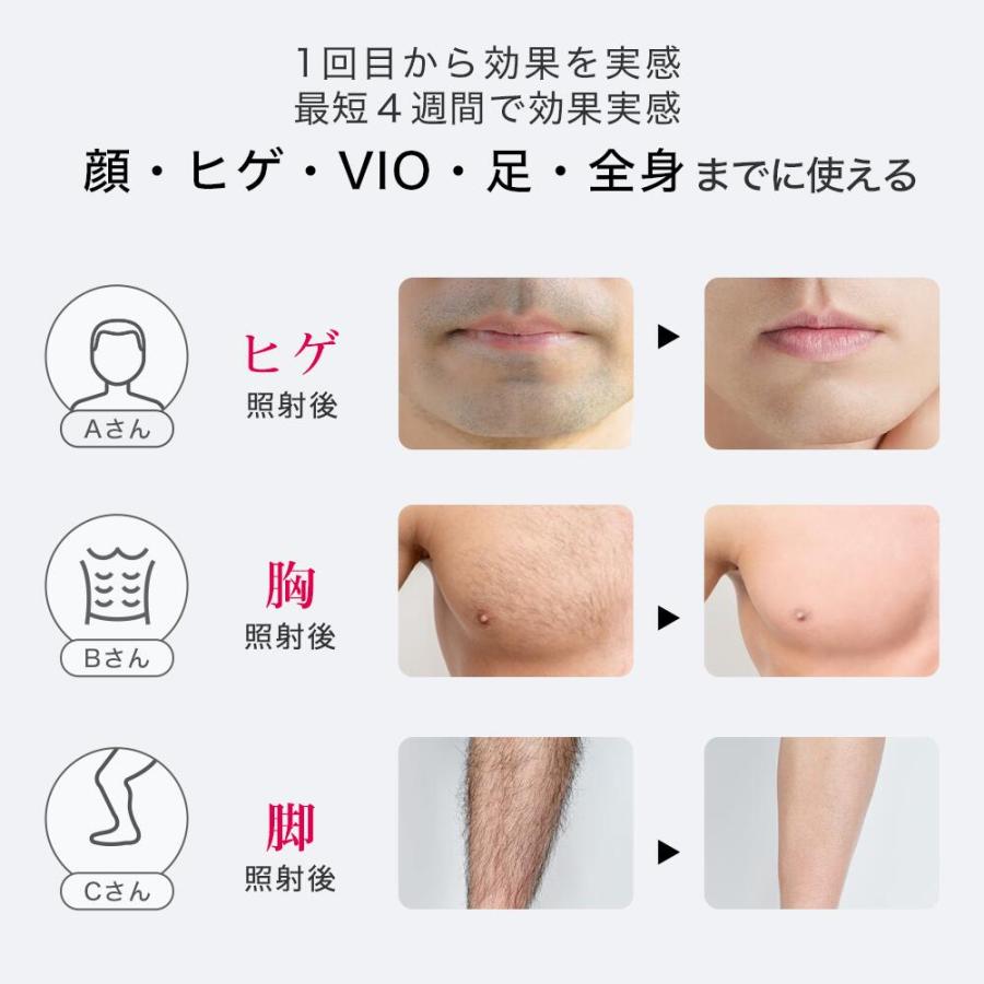 ＼クーポンで24,940円！2/2〜2/28／Ulike公式 Air2 光美容器 脱毛 vio ムダ毛処理 フラッシュ脱毛 美顔器 メンズ レディース 痛みレス 男女兼用 ヒゲ脱毛 髭脱毛 | Ulike | 03