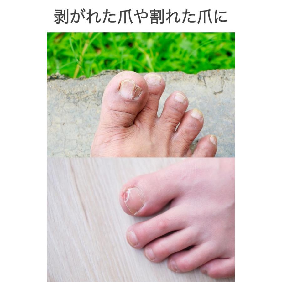 新色追加して再販 足指キャップ 2サイズセット 親指用1足 他の指用1足 シリコン 足指 保護 サポーター プロテクター つま先 爪 足爪 衝撃吸収 白 足指サック キャップ 新登場