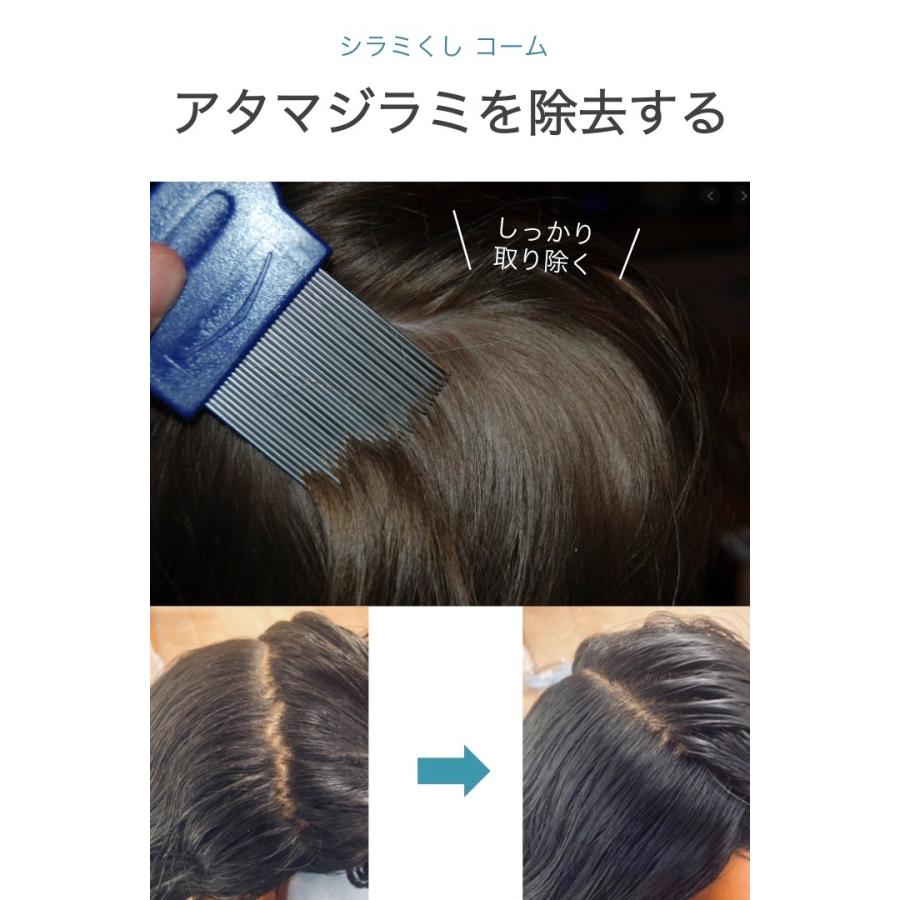 シラミくし 1個 頭ジラミ 卵 成虫 駆除 除去 コーム 櫛 シラミとり しらみ 頭 子供 ステンレス シンプル コンパクト アタマジラミ 虱 ニット 0493 便利雑貨ショップumiwo 通販 Yahoo ショッピング