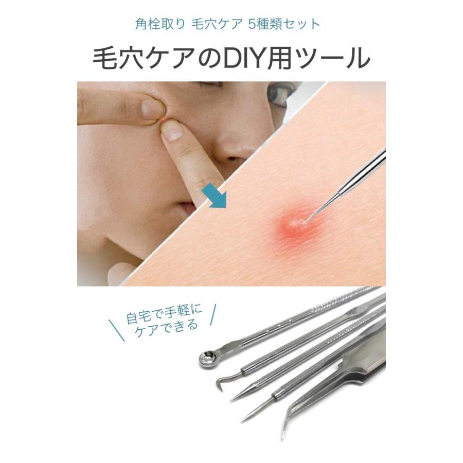 84%以上節約 角栓取り 4本セット ニキビ 針 ニキビケア スキンケア 角栓除去 プッシャー ニキビ ニキビケア 4本セット 角栓 毛穴 スキンケア