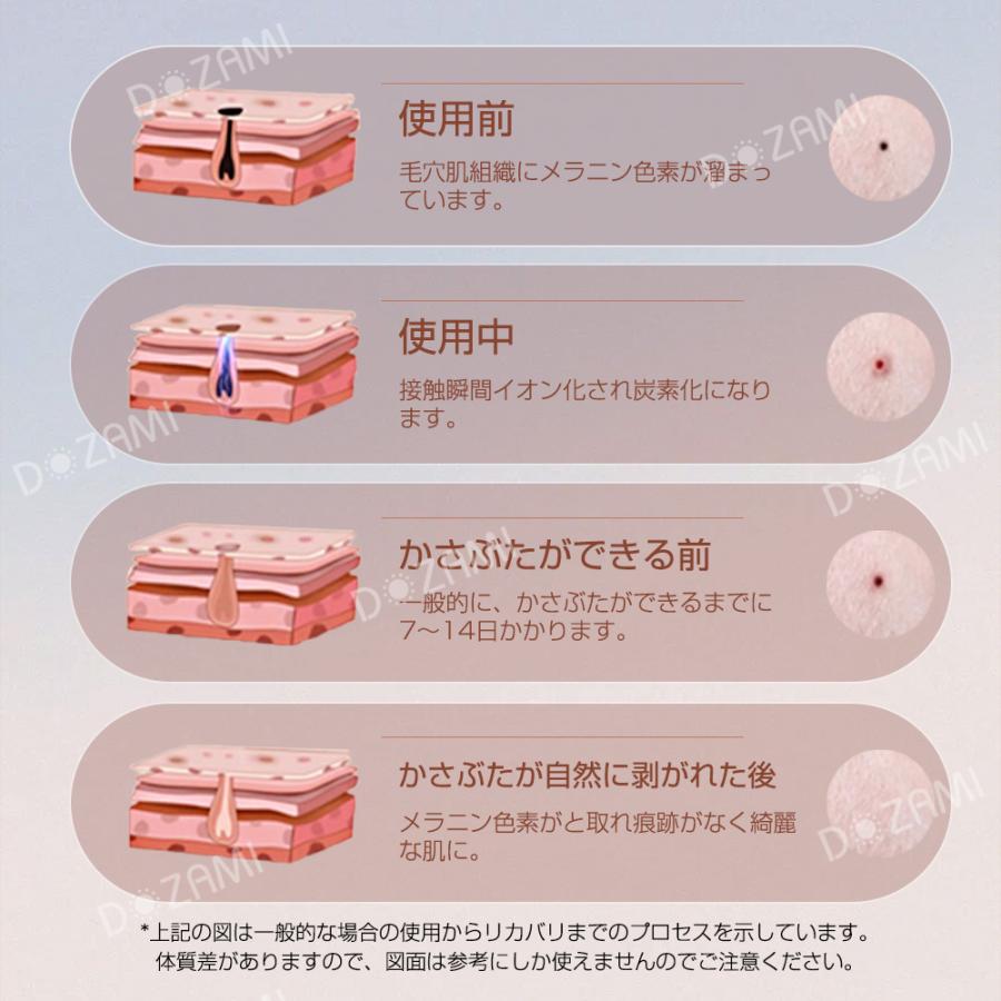 レーザーペン ほくろ除去ペン 美顔器 家庭用 そばかす 除去ツール 9階段 シミ取り ホクロ イボ シミ ミニケア 美肌美顔 安全 サロン級 DZ03｜unocoline｜08