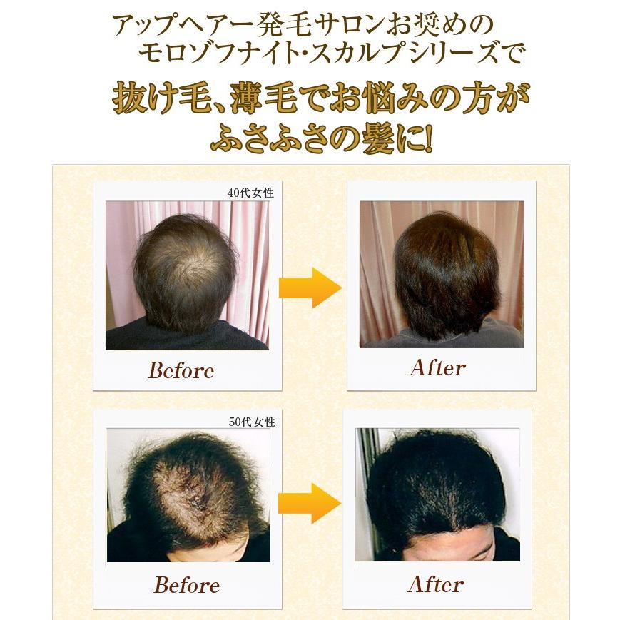 モロゾフナイト スカルプシャンプー ビオ／頭皮 毛穴 男性用女性用 ノンシリコン 無添加 スカルプ シャンプー |  | 10