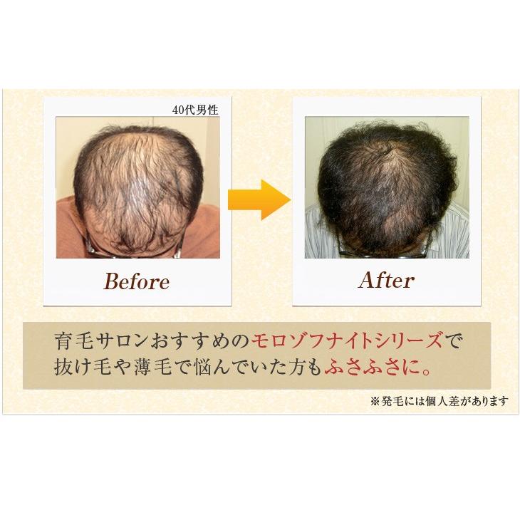 モロゾフナイト スカルプシャンプー ビオ／頭皮 毛穴 男性用女性用 ノンシリコン 無添加 スカルプ シャンプー |  | 11