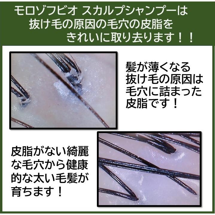 モロゾフビオ スカルプシャンプー ／ 頭皮 毛穴 男性用 女性用 ノンシリコン 無添加 スカルプ シャンプー |  | 06