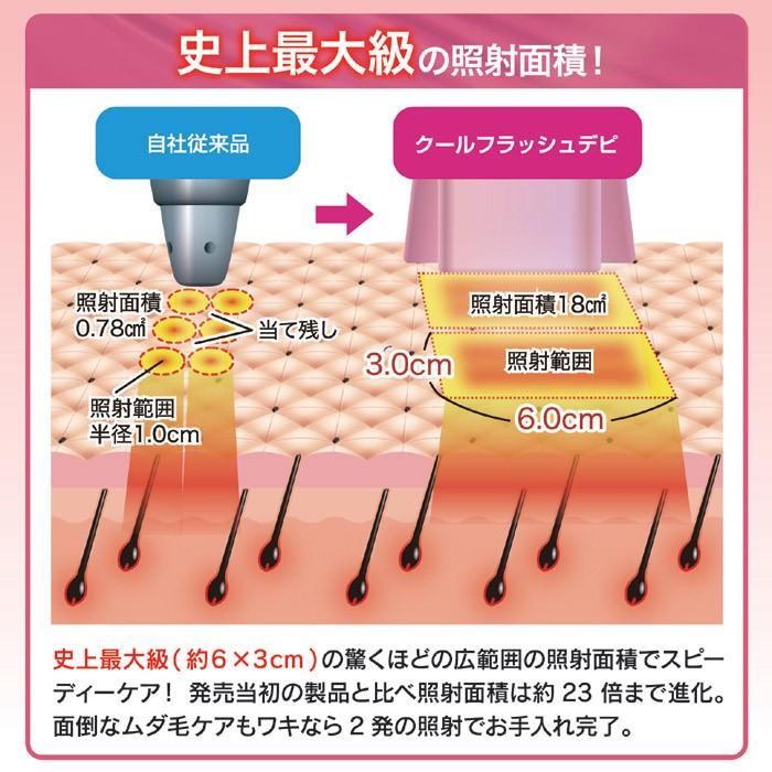 ワキ毛処理 わき毛脱毛 男性 女性 脱毛 器具 むだ毛 処理 キセノンランプ 広範囲 脚 足 腕 手 日本 国産 オムニ Gto うさぎ屋 株式会社一兎 通販 Yahoo ショッピング