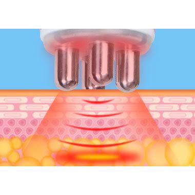 家庭・業務用7in1 40KHZキャビテーション/光ラジオ波/バキューム/BIO/冷却機能付き76D1 |  | 01