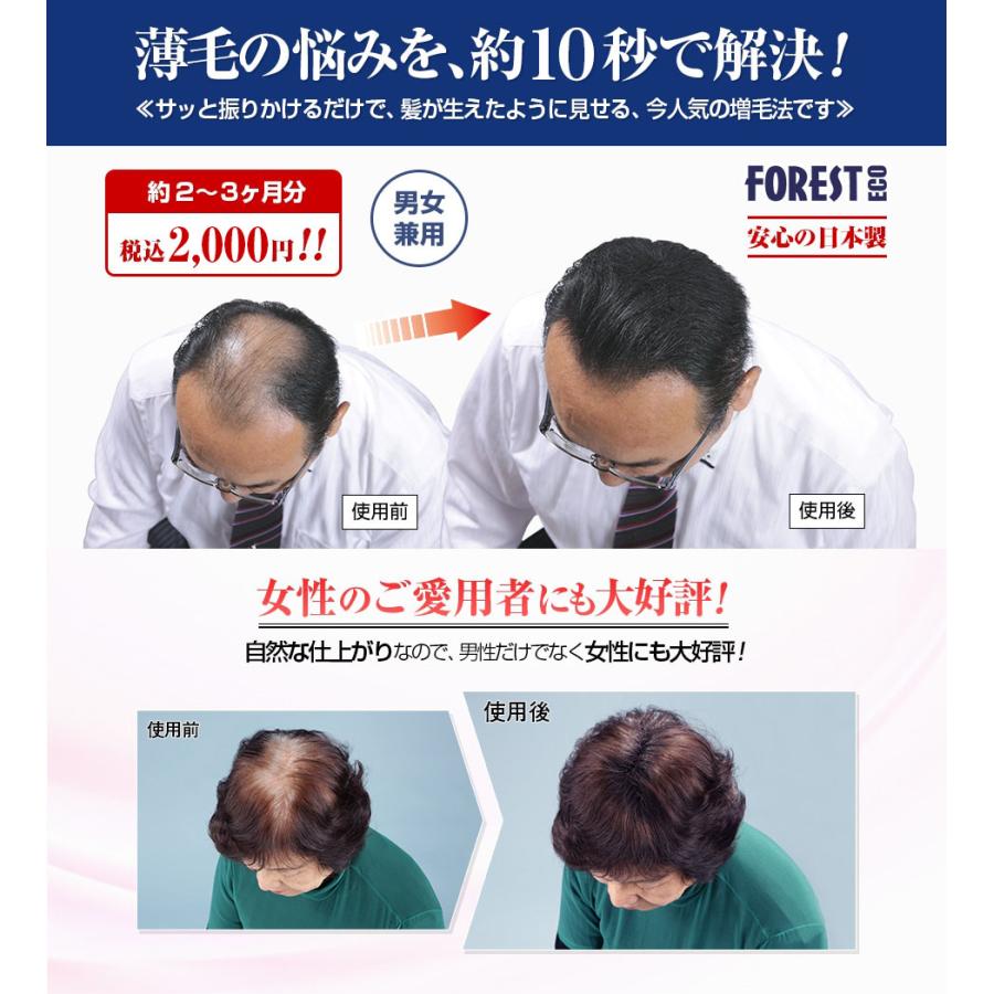 薄毛増毛ふりかけパウダー詰め替え用2個 脱毛症分け目白髪かくしハゲ