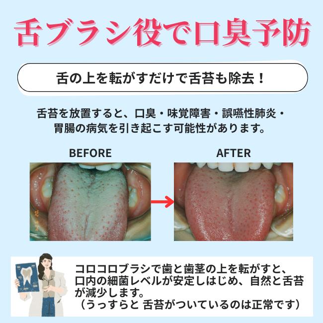 歯ブラシ 公式 ころころ歯ぶらし 3本 歯科医推奨 歯医者おすすめ 歯周病 舌ブラシ コロコロブラシ 歯槽膿漏 口臭改善 歯茎マッサージ デンタルエステ 奇跡の | COLOCOLOBRUSH | 12