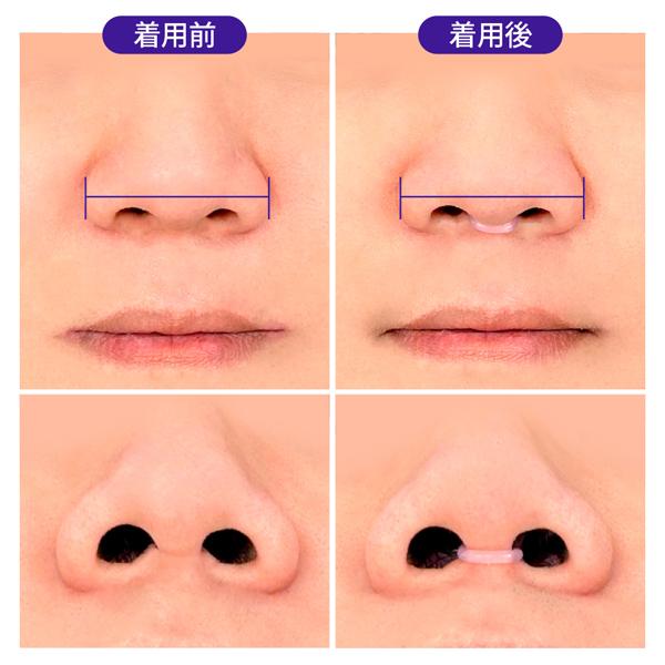 おやすみ いびき いびき防止グッズ 2個入り 拡張 NOSK 運動 勉強 集中力 無呼吸症候群対策 洗いOK 専用ケース付き 鼻腔拡張 睡眠 快眠 不眠 口呼吸 鼾 ネコポス |  | 03