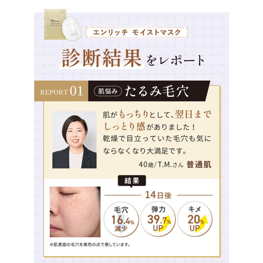 VERNAL（ヴァーナル） エンリッチ モイストマスク 1箱(6枚入り) ハリ