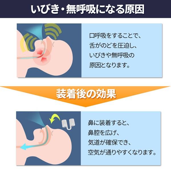 いびき防止グッズ 鼻呼吸 トレーニング ノーズピン いびき対策 鼻腔拡張器 快眠グッズ 快眠 サポート 小型 コンパクト 2個セット 対策 軽量 旅行 安眠グッズ｜versos｜04