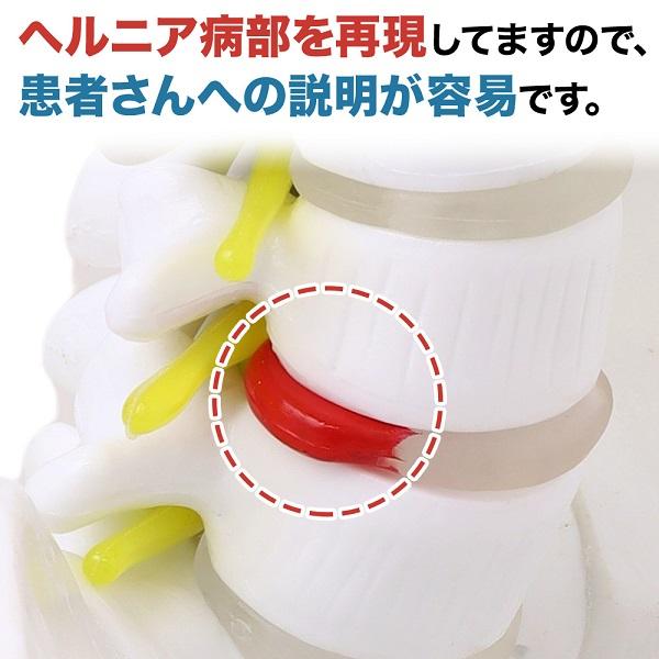 脊椎 模型 人体模型 1/2 脊椎骨盤 骨盤 骨 45センチ 脊髄骨盤 脊椎 模型 人体模型 1/2 脊椎骨盤 骨盤 骨 45センチ 脊髄骨盤