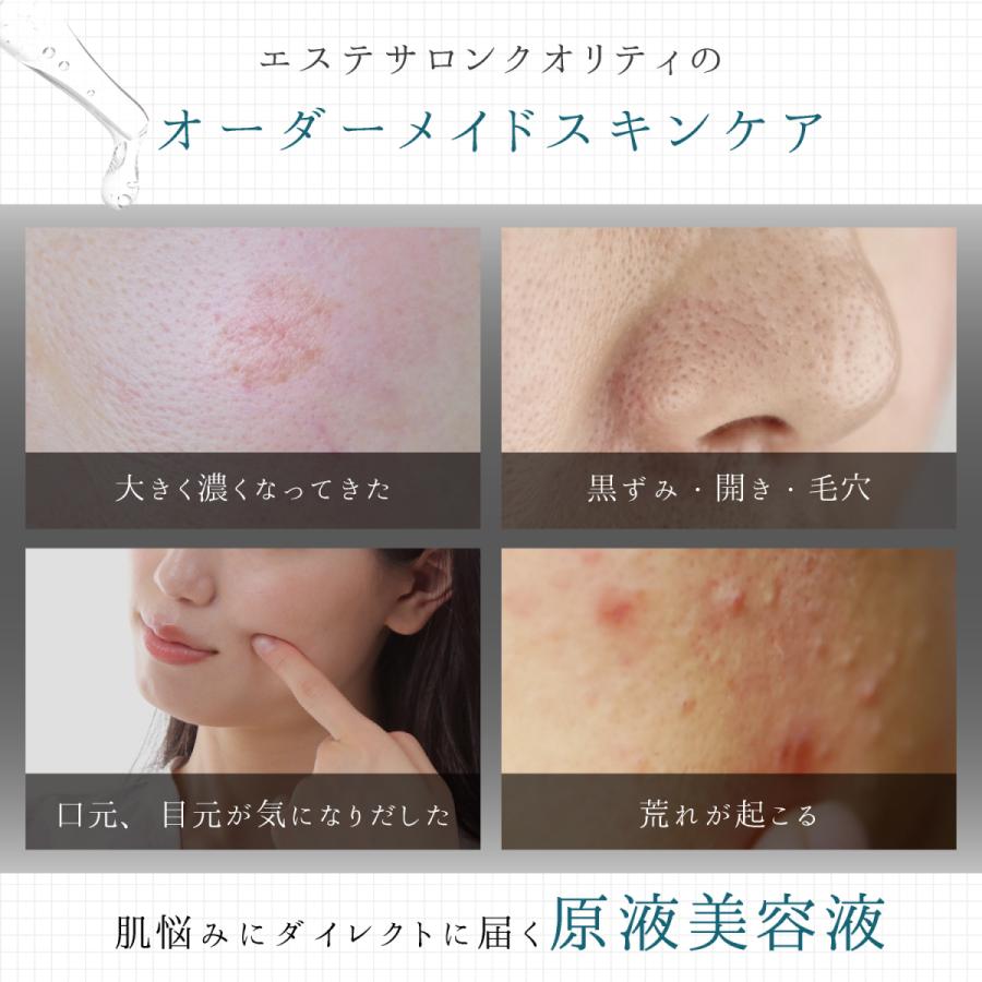 天然植物エキス 原液 美容液  EGX アイテム ソリューション オーダーメイドスキンケア 10ml 敏感肌 低刺激 シワ 年齢肌 白肌 |  | 03