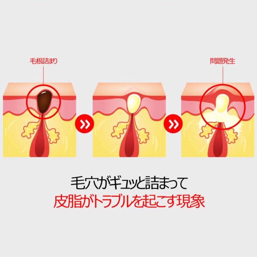 FAU 日本公式 ショップ】プロ ポリスエキス10% ツボクサ ティ ーツリー