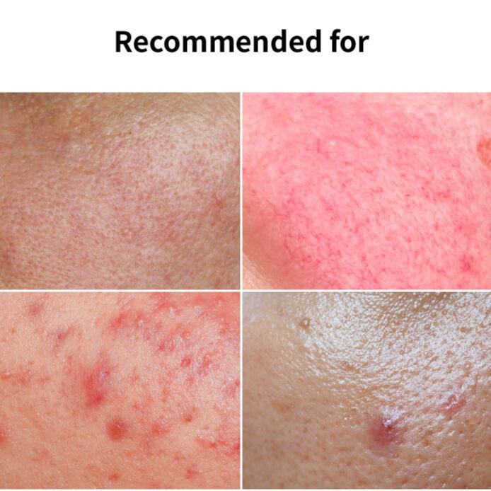 FAU 日本公式 ショップ】プロ ポリスエキス10% ツボクサ ティ ーツリー